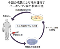 ポンチ図２